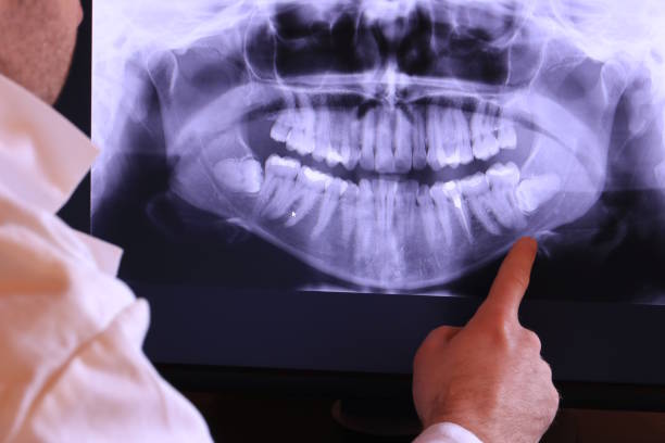 Best Cosmetic Emergency Dentistry in Osburn, ID