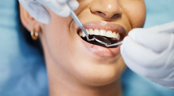 Best Emergency Tooth Extraction in Osburn, ID